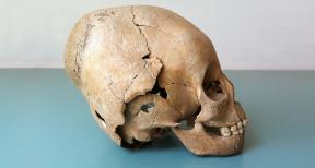 Hun skull